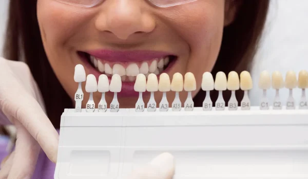 dentist-examining-female-patient-with-teeth-shades dentist-examining-female-patient-with-teeth-shades